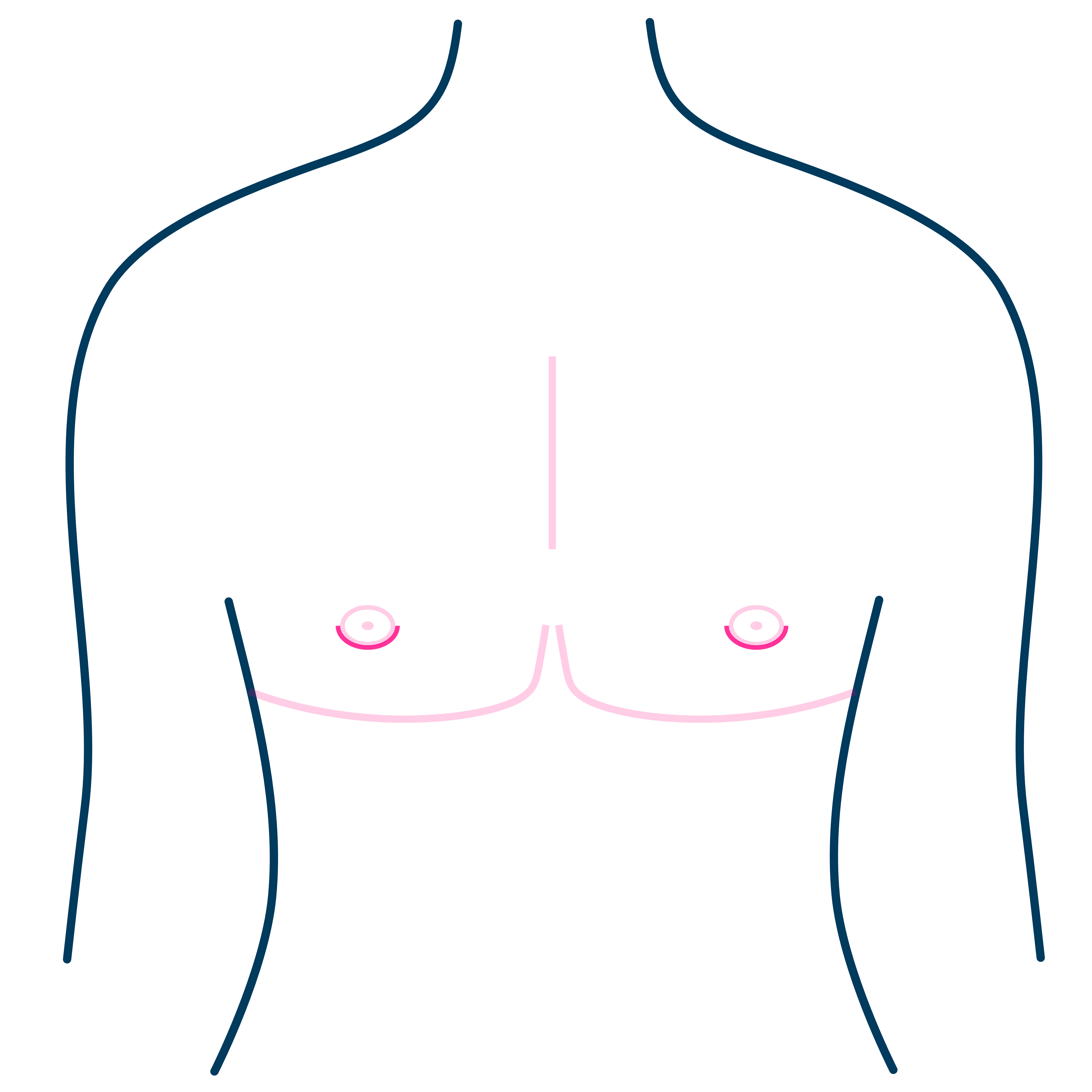 Double Incision Mastectomy Scar Placement