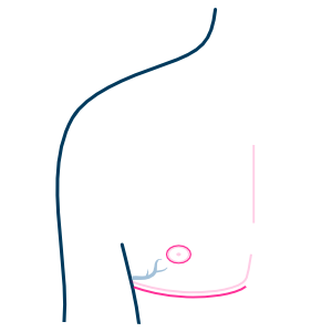 Male and Female Chest